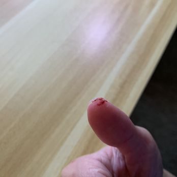 Linhs Nails - Cut thumb - Skin Care Near Me - College Station, Texas