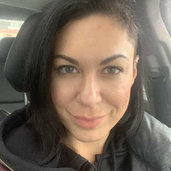 Steven J. Rottman, MD - Filler under eye, dysport, and lips! I am 41 and look 30!! - Plastic Surgeons Near Me - Owings Mills, Maryland Steven J. Rottman, MD - Filler under eye, dysport, and lips! I am 41 and look 30!! - Plastic Surgeons Near Me - Owings Mills, Maryland
