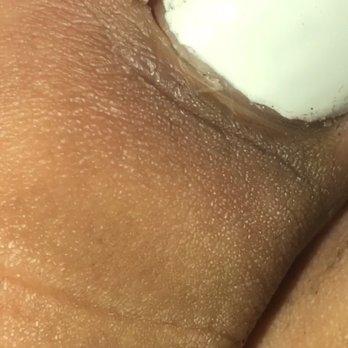 Studio Nails & Spa - Dried blood and fresh pus - Nail Salons Near Me - Pico Rivera, California