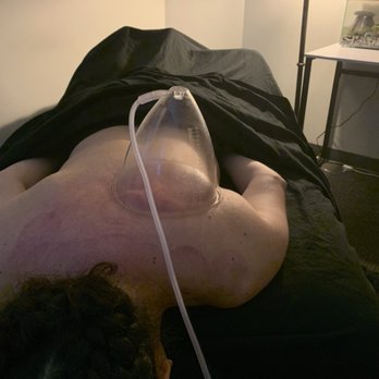 Superior Body Wellness - Medi-Cupping Therapyv - Body Contouring Near Me - Aurora, Colorado Superior Body Wellness - Medi-Cupping Therapyv - Body Contouring Near Me - Aurora, Colorado