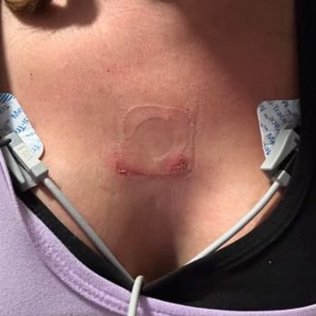 Henderson Hospital - Burns from heart monitors! - Hospitals Near Me - Henderson, Nevada Henderson Hospital - Burns from heart monitors! - Hospitals Near Me - Henderson, Nevada