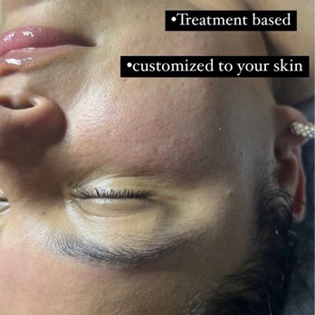 Skin Tin Esthetics - Skin Care Near Me - Charlotte, North Carolina Skin Tin Esthetics - Skin Care Near Me - Charlotte, North Carolina