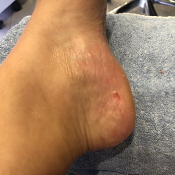 Metro Nail Lounge - Scrubbed my heels until it bled! - Nail Salons Near Me - Corona, California