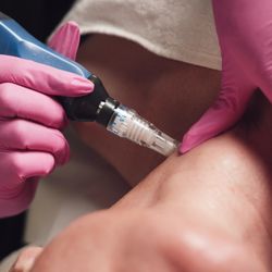 Eurolook Med Spa & Salon - Experience EUROLOOK MED SPA & SALON SkinPen Microneedling, customized facials or Hydrafacial - book today
