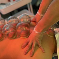 Situ Healing - Cupping and Manual Therapy