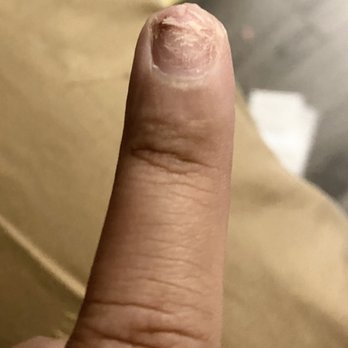 Lavender Nail Lounge - Full set after two weeks. Tip was glued to my skin and resulted in bleeding when it started to lift. - Nail Salons Near Me - San Diego, California