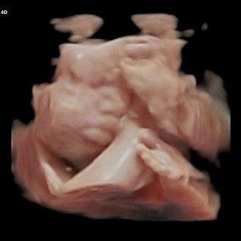 TomorrowToday Ultrasound - Ultrasound Imaging Centers Near Me - Aiea, Hawaii TomorrowToday Ultrasound - Ultrasound Imaging Centers Near Me - Aiea, Hawaii