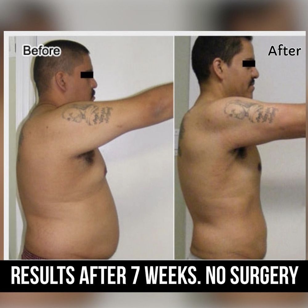 TOP 10 BEST Weight Loss Clinic in Downey, CA - Updated 2026 - Quality & Affordability