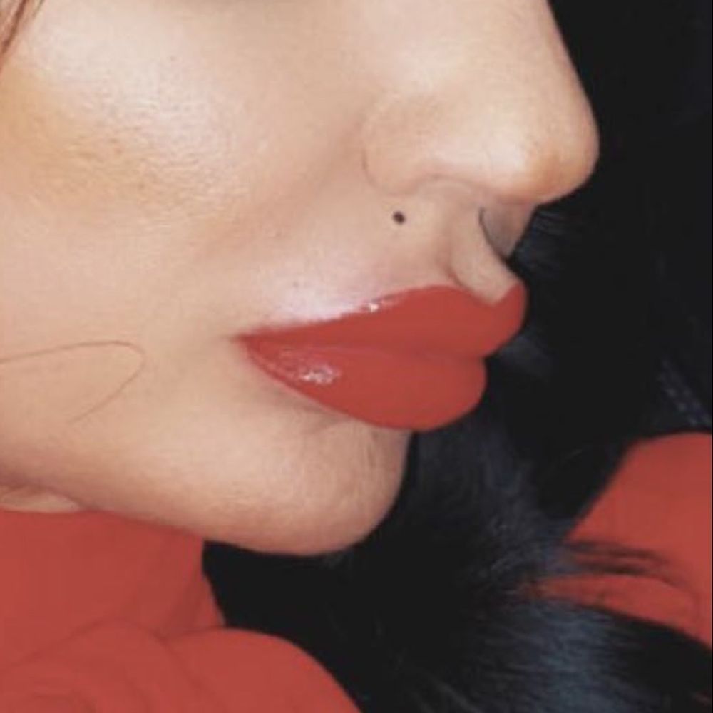 Cloud 9 Medi Spa - Lip filler using Juvederm Vollure for a pout that will last and keep its shape - Medical Spas Near Me - Yucaipa, California Cloud 9 Medi Spa - Lip filler using Juvederm Vollure for a pout that will last and keep its shape - Medical Spas Near Me - Yucaipa, California