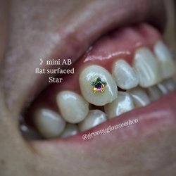 Groovy Glow Teeth Whitening
