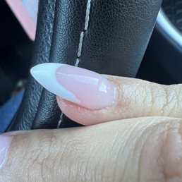 Bulky uneven nail Bulky uneven nail