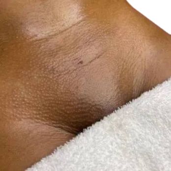 Waxing By Akeya Young - Specializing in the Brazilian wax. - Hair Removal Near Me - Washington, DC, District of Columbia