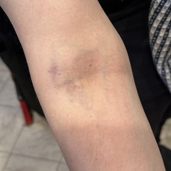 Quest Diagnostics - more hematoma - Laboratory Testing Near Me - Northridge, California