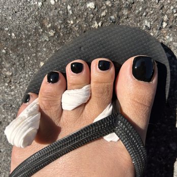 Angel Nails - What is the space on the middle and pointer toenails? tech said - Nail Salons Near Me - Monterey, California Angel Nails - What is the space on the middle and pointer toenails? tech said - Nail Salons Near Me - Monterey, California