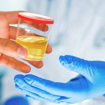 ADAT - We offer drug and alcohol tests. Rapid and lab tests available. - Laboratory Testing Near Me - San Diego, California ADAT - We offer drug and alcohol tests. Rapid and lab tests available. - Laboratory Testing Near Me - San Diego, California