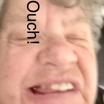 High Desert Dental - My tongue rested on the platforms of his crowns, and I constantly bit it. - General Dentistry Near Me - Albuquerque, New Mexico High Desert Dental - My tongue rested on the platforms of his crowns, and I constantly bit it. - General Dentistry Near Me - Albuquerque, New Mexico