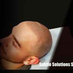 Subtle Solutions Scalp Micropigmentation - Subtle Solutions Scalp Micropigmentation
