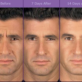 Lara Devgan, MD - Plastic & Reconstructive Surgery - Cosmetic Surgeons Near Me - New York, New York
