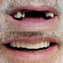 Novi Reconstructive Dentistry