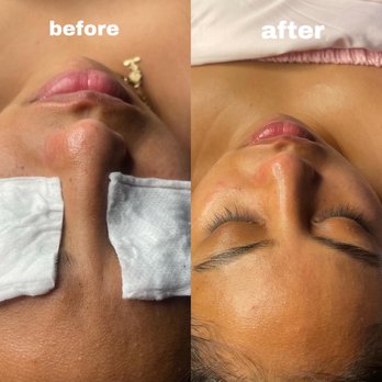 Bella's Dream Skin - Skin Care Near Me - Winter Haven, Florida Bella's Dream Skin - Skin Care Near Me - Winter Haven, Florida