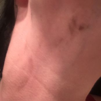 SmartStyle - Awful service. Left with stains on my neck - Hair Salons Near Me - JACKSON, Michigan
