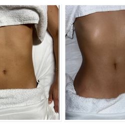 Brazilian Body Sculpting - Sculpting Detox