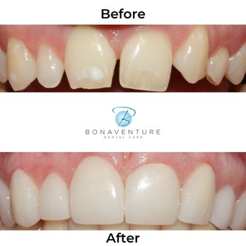 Bonaventure Dental Care - Cosmetic Dentists Near Me - Baton Rouge, Louisiana Bonaventure Dental Care - Cosmetic Dentists Near Me - Baton Rouge, Louisiana