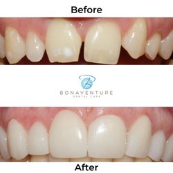 Bonaventure Dental Care