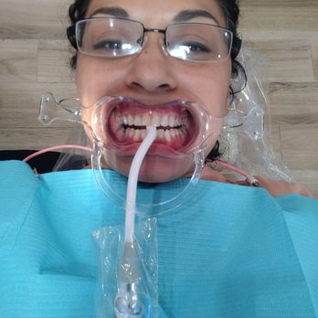 NELA Orthodontics - Not a flattering pic AT ALL! - Orthodontists Near Me - Los Angeles, California