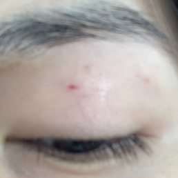 It look worst in person. So many cut for an eyebrow threading Session.