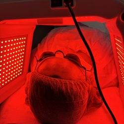 Bianchelos Skincare Essentials - Photodynamic Therapy for Skin Rejuvination