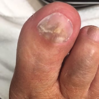 Nail Therapy by Vera - Post Medicinal Construction - Skin Care Near Me - Santa Monica, California