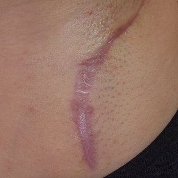 Coastal Plastic Surgeons - Cosmetic Surgeons Near Me - Poway, California Coastal Plastic Surgeons - Cosmetic Surgeons Near Me - Poway, California