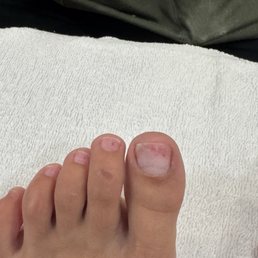 Had to go to my usual salon in NYC after to find my feet looking like this sensitive to the touch.