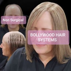 Bollywood Hair Systems - Hair Loss Replacement