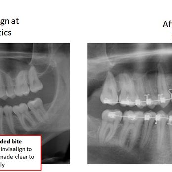 Casthely Orthodontics - Orthodontists Near Me - Miami, Florida Casthely Orthodontics - Orthodontists Near Me - Miami, Florida