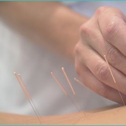 Arundel Acupuncture