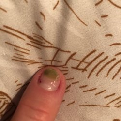 Bt Nails