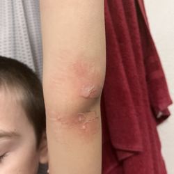 Advanced Desert Dermatology