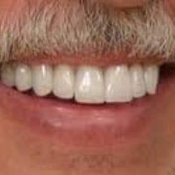 Ted French DDS - General Dentistry Near Me - Arlington, Texas