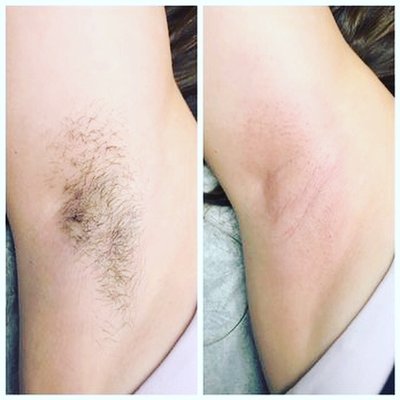 Waxing services include
Under Arm,
Brazilian,
Full Face,
Eyebrows and more. - Full Body & Brazilian Waxing Available ! Waxing services include
Under Arm,
Brazilian,
Full Face,
Eyebrows and more. - Full Body & Brazilian Waxing Available !