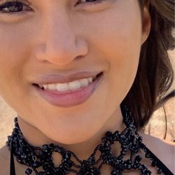 Plastic Surgery in Tijuana - In the wrong lighting it's really noticeable