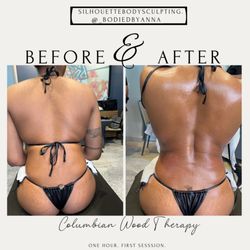 Silhouette Body Sculpting - One hour of wood therapy before and after . First session.