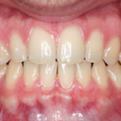 Peter L Clemente, DMD- Orthodontic Associates