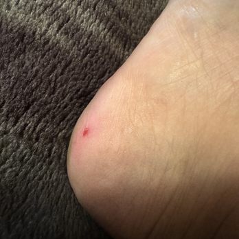 Award Nails & Spa - The lady that did my feet was complaining the whole time. And even cut me while doing the callus treatment. And obviously hurts - Nail Salons Near Me - Mesa, Arizona Award Nails & Spa - The lady that did my feet was complaining the whole time. And even cut me while doing the callus treatment. And obviously hurts - Nail Salons Near Me - Mesa, Arizona