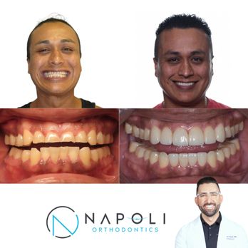 Napoli Orthodontics - Orthodontists Near Me - Stuart, Florida Napoli Orthodontics - Orthodontists Near Me - Stuart, Florida