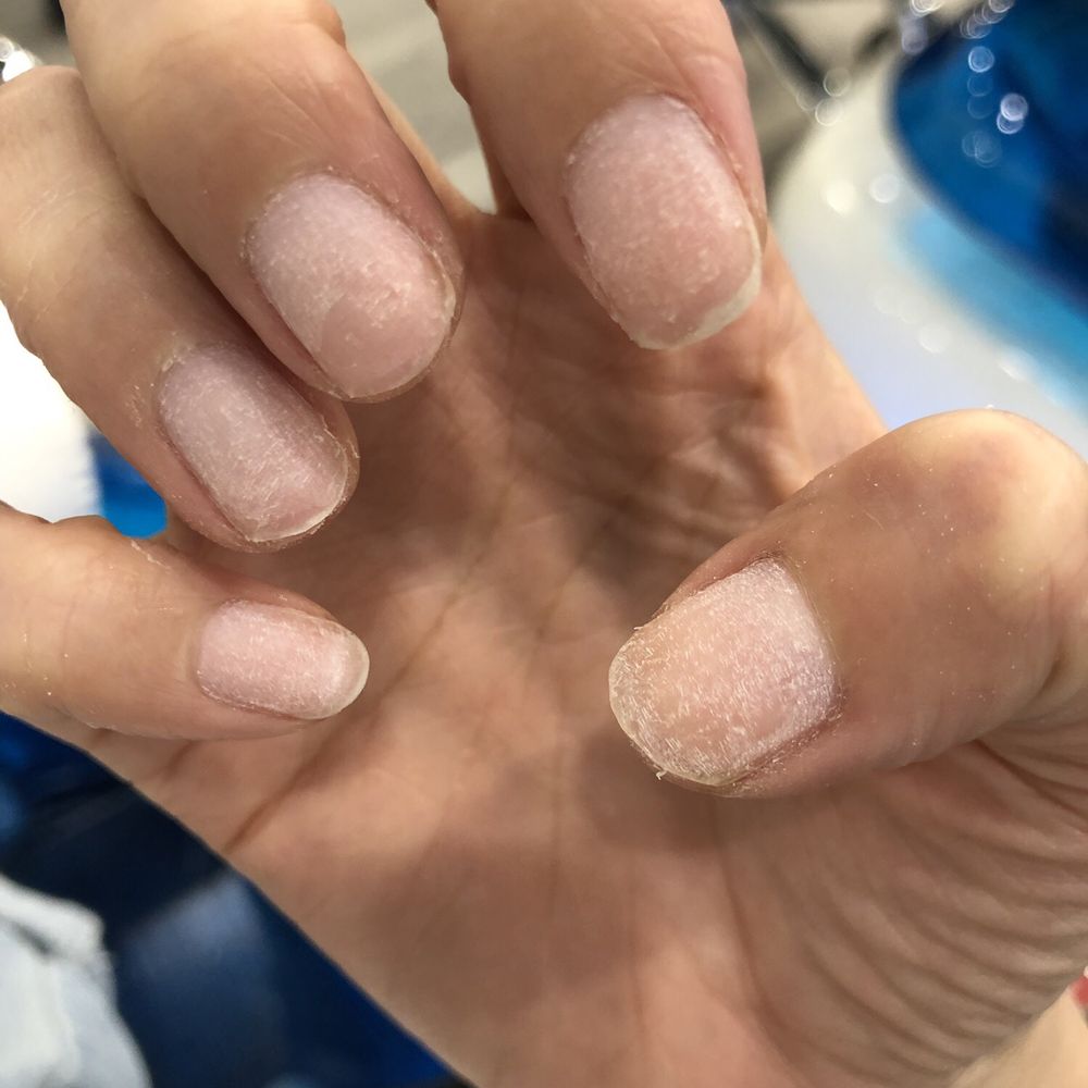 Stella Nails - Hands and my poor nails - Nail Salons Near Me - Vancouver, British Columbia Stella Nails - Hands and my poor nails - Nail Salons Near Me - Vancouver, British Columbia