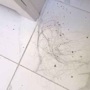 Hair One Salon - Some flakes and hair that fell out of my scalp - there was more to this all over my bedroom floor and the rest of my bathroom floor as well. - Hair Salons Near Me - Flushing, New York Hair One Salon - Some flakes and hair that fell out of my scalp - there was more to this all over my bedroom floor and the rest of my bathroom floor as well. - Hair Salons Near Me - Flushing, New York