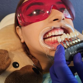 LS Whitening Studio - verify current color - Teeth Whitening Near Me - Katy, Texas