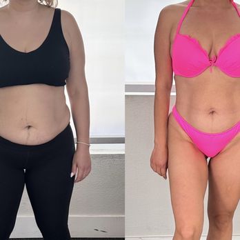 Lotus Unfolded - Client before / after progress photo - Trainers Near Me Lotus Unfolded - Client before / after progress photo - Trainers Near Me